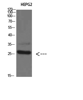 Tryptase-3 Polyclonal Antibody - Absci