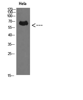 Perforin 1 Polyclonal Antibody - Absci