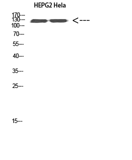 Ret Polyclonal Antibody - Absci