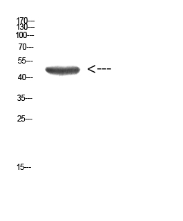 Cytokeratin 14/17 Polyclonal Antibody - Absci