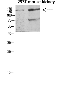 Flt-4 Polyclonal Antibody - Absci