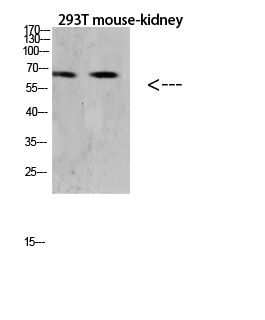 RANK Polyclonal Antibody - Absci