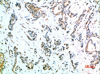 CD64 Polyclonal Antibody - Absci