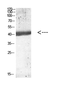 IL-12B p40 Polyclonal Antibody - Absci