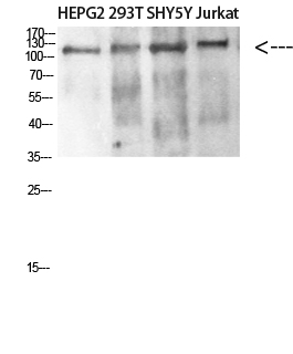 DAAM1 Polyclonal Antibody - Absci