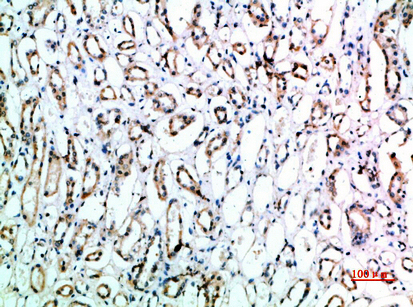CD151 Polyclonal Antibody - Absci