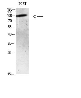 AR (Acetyl Lys633) Polyclonal Antibody - Absci