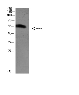 FoxO4 (Acetyl Lys189) Polyclonal Antibody - Absci