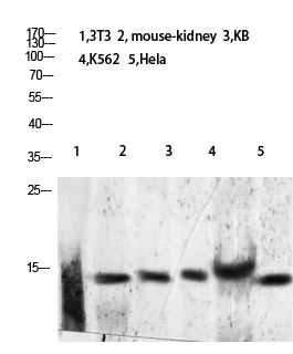 Histone H2B (Acetyl-Lys24/25) Polyclonal Antibody - Absci