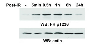 FH (Phospho-Thr236) Antibody - Absci