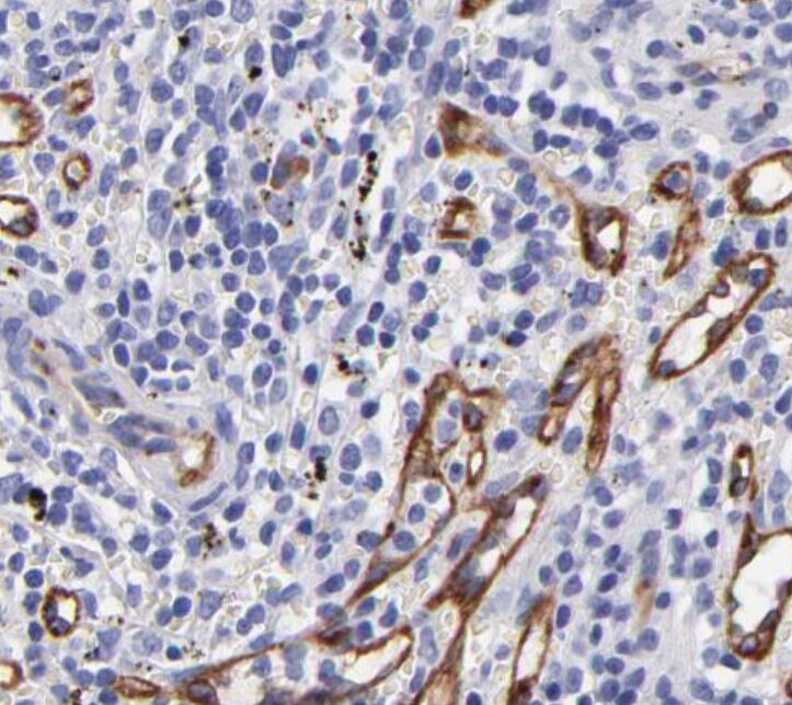 CD93 Antibody - Absci