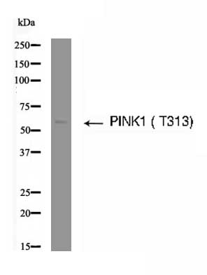 PINK1 (Phospho- Thr313) Antibody