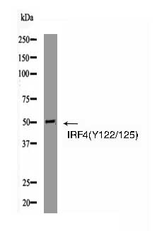 IRF4(Phospho-Tyr122,125) antibod