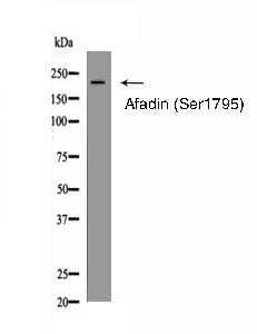 Afadin (Phospho-Ser1795) Antibody 