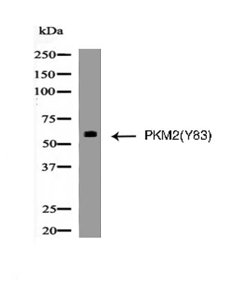 PKM2(Phospho-Tyr83) Antibody - Absci