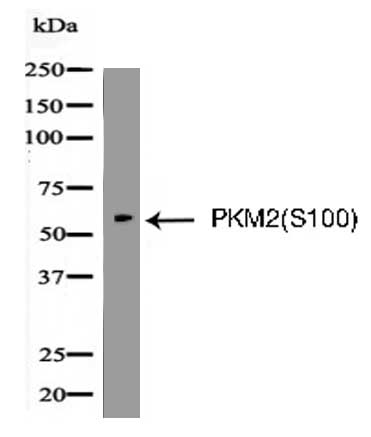 PKM2(Phospho-Ser100) Antibody
