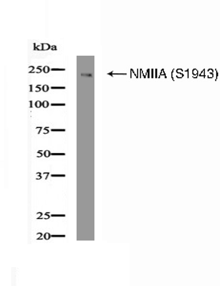 NMIIA (Phospho-Ser1943) Antibody - Absci