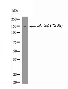 LATS2 (Phospho-Tyr286) Antibody