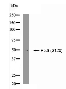 Rpt6 (Phospho-Ser120) Antibody - Absci