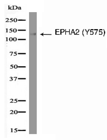 EPHA2 (Phospho-Tyr575) Antibody