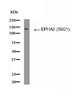 EPHA2 (Phospho-Ser901) Antibody