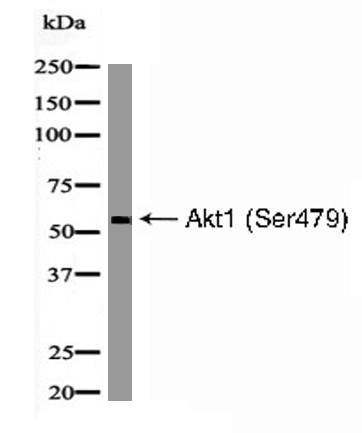 phospho-Akt1 (Phospho-Ser479) Antibody