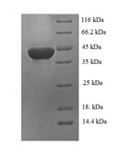 Recombinant Rat Carbonic anhydrase 1(Ca1) - Absci