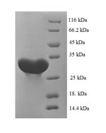 Recombinant Rat Carbonic anhydrase 1(Ca1) - Absci