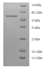 Recombinant Human Cystathionine beta-synthase(CBS),partial - Absci