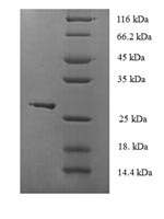 Recombinant Human Glutathione peroxidase 1(GPX1) - Absci