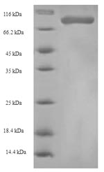 Recombinant Human Heterogeneous nuclear ribonucleoprotein L(HNRNPL) - Absci