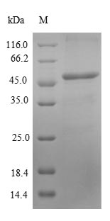 Recombinant Human Antigen KI-67(MKI67),partial - Absci