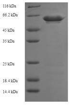 Recombinant Human 2-5A-dependent ribonuclease(RNASEL),partial - Absci