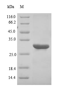 Recombinant Epstein-Barr virus Capsid protein VP26 (BFRF3),partial