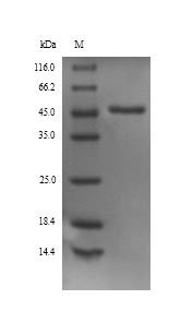 Recombinant Rat Alpha-1-antiproteinase(Serpina1)  - Absci