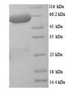 Recombinant Rat Putative phospholipase B-like 2(Plbd2) - Absci