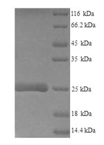 Recombinant Mouse Lymphocyte antigen 6E(Ly6e)