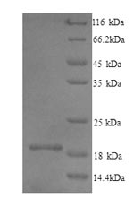 Recombinant Mouse Interleukin-1 family member 10(Il1f10)