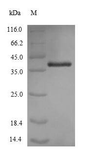 Recombinant Acinetobacter baumannii Outer membrane protein Omp38(omp38)