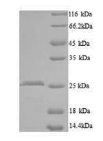 Recombinant Mouse WNT1-inducible-signaling pathway protein 2(Wisp2) - Absci