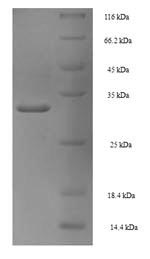 Recombinant Human Proliferating cell nuclear antigen(PCNA) - Absci