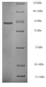 Recombinant Saccharomyces cerevisiae Proliferating cell nuclear antigen(POL30)