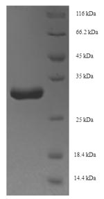 Recombinant Staphylococcus aureus Holo-[acyl-carrier-protein] synthase(acpS)