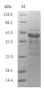 Recombinant Microbacterium testaceum N-acyl homoserine lactonase(aiiM) - Absci