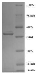 Recombinant Human Growth/differentiation factor 11(GDF11) - Absci