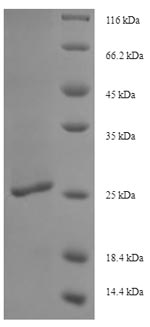 Recombinant Salmonella typhi LPS-assembly protein LptD(lptD),partial - Absci