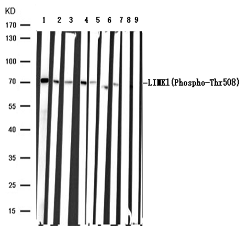 LIMK1(Phospho-Thr508) Antibody - Absci