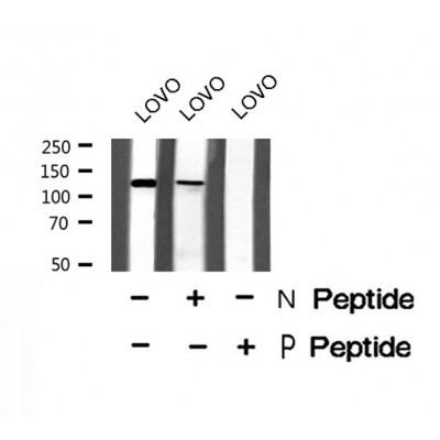 PDE3A (Phospho-Ser312) Antibody - Absci