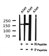 LATS1 (Phospho-Thr1079) Antibody - Absci