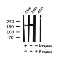 LATS1 (Phospho-Thr1079) Antibody